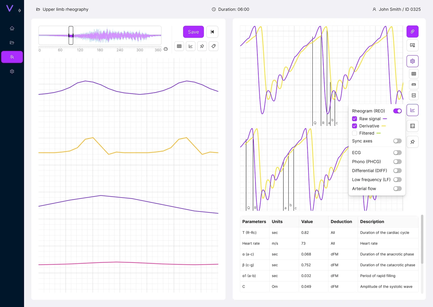 Signal channel visibility controls