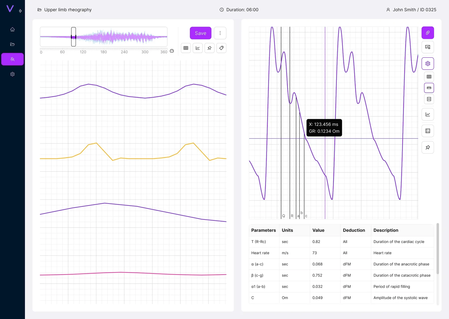 Graph ruler and measurement tooltip