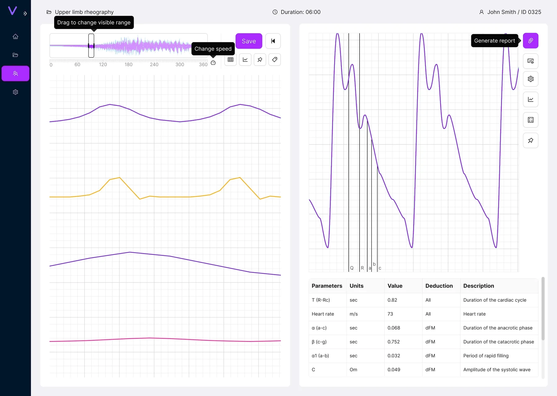 VascuLab cardiovascular signal analysis workspace