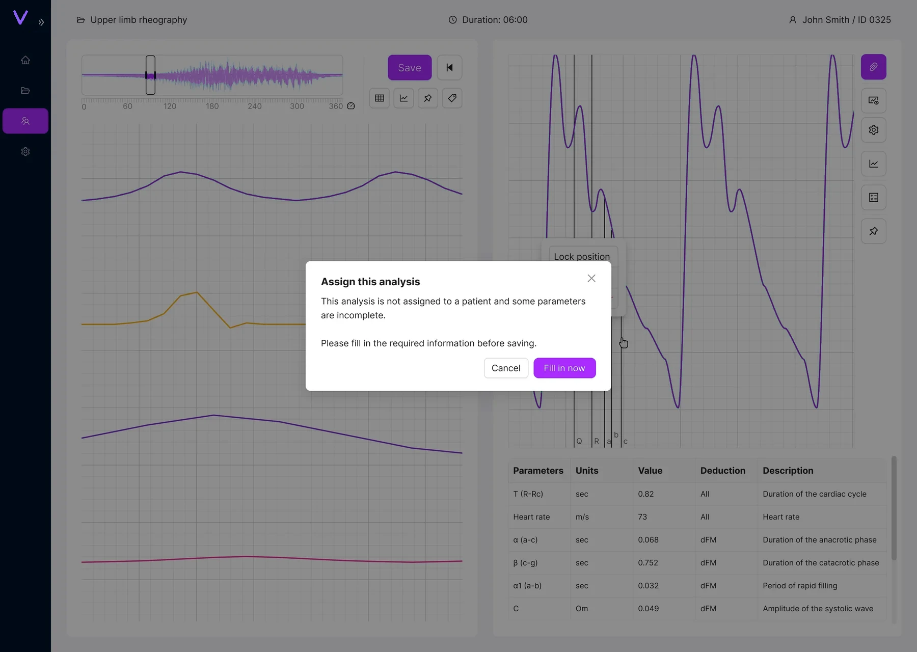 Assign analysis to patient warning