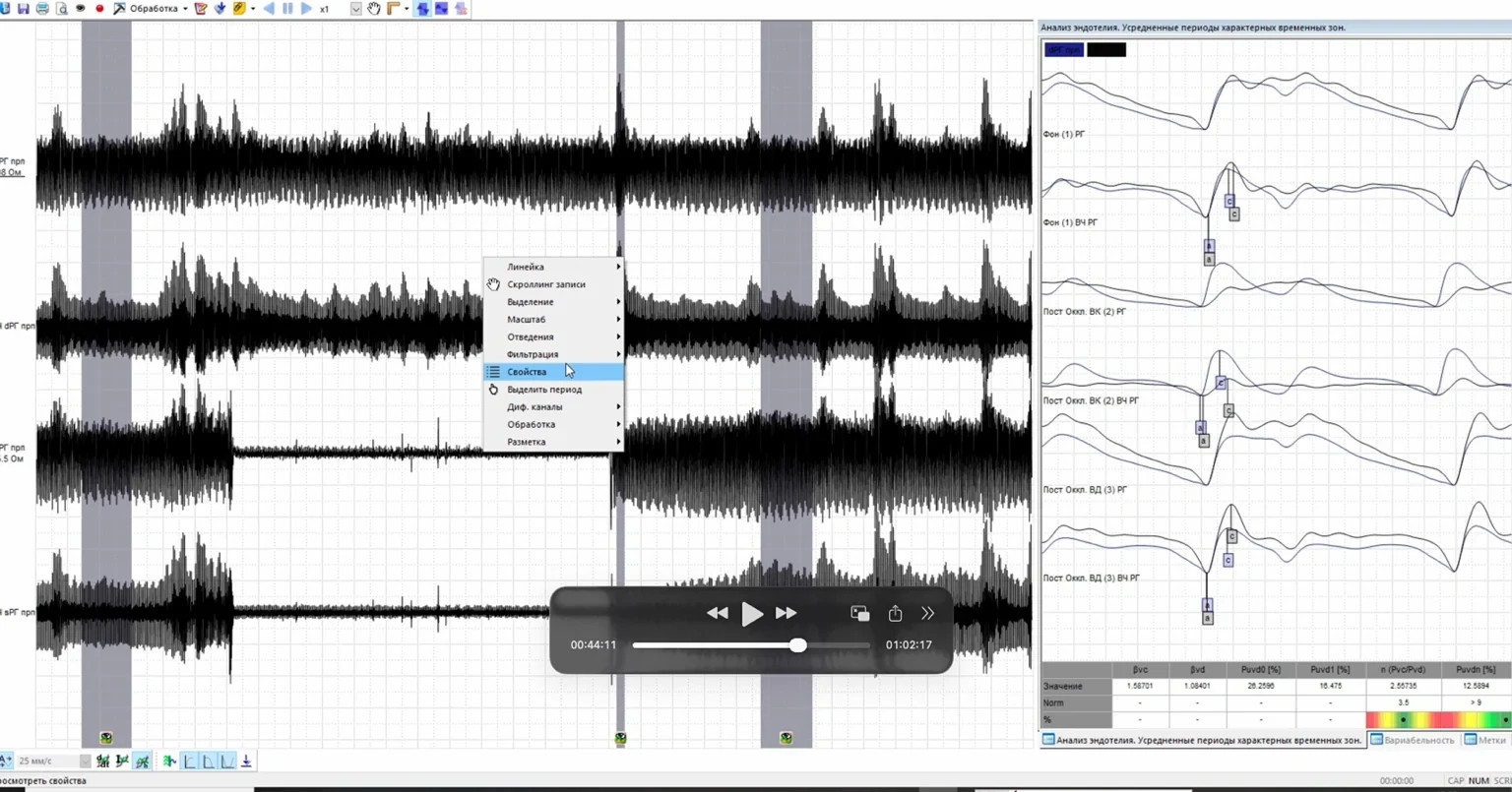 Legacy VascuLab recording workspace