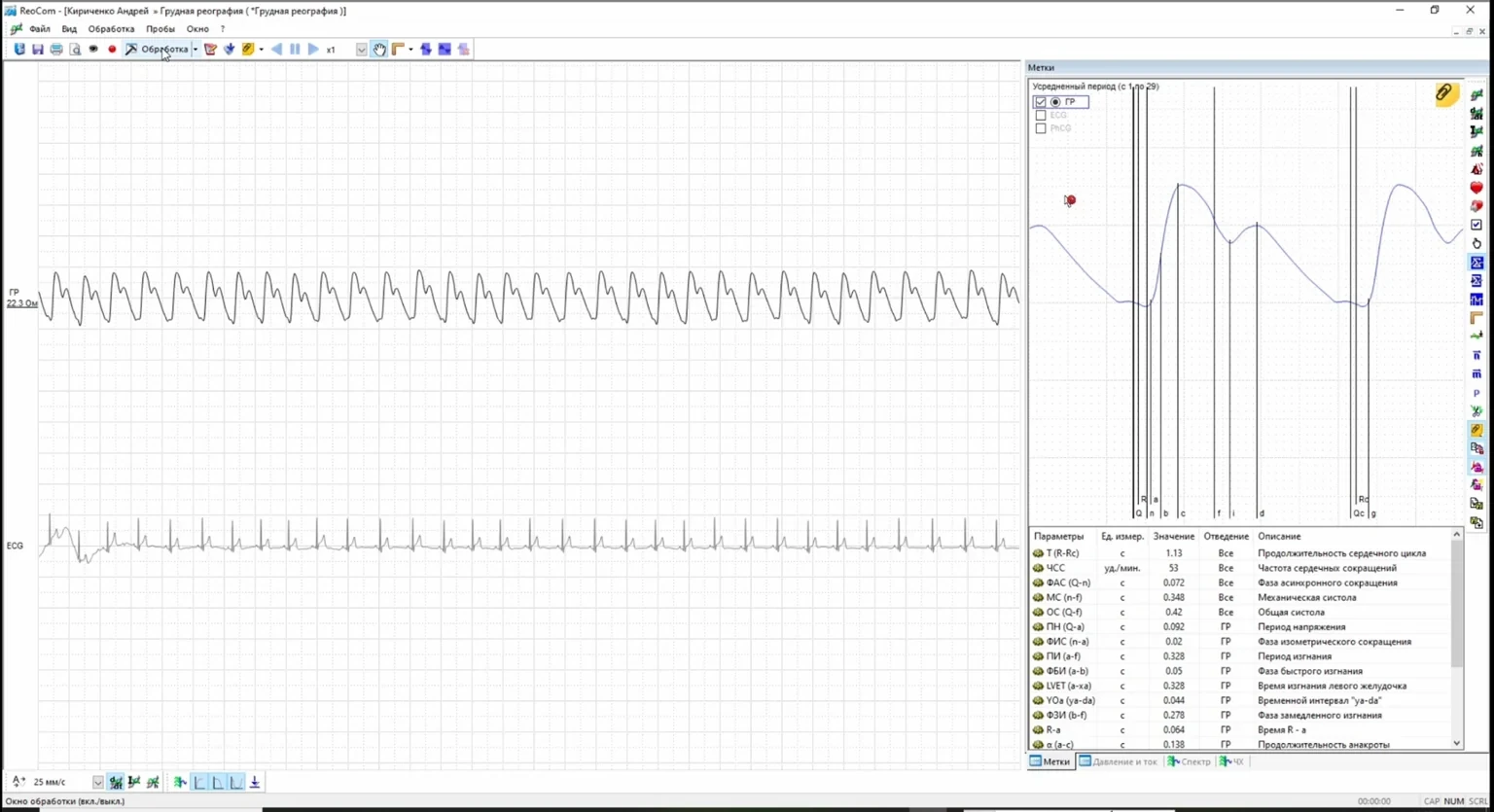 Legacy VascuLab analysis screen