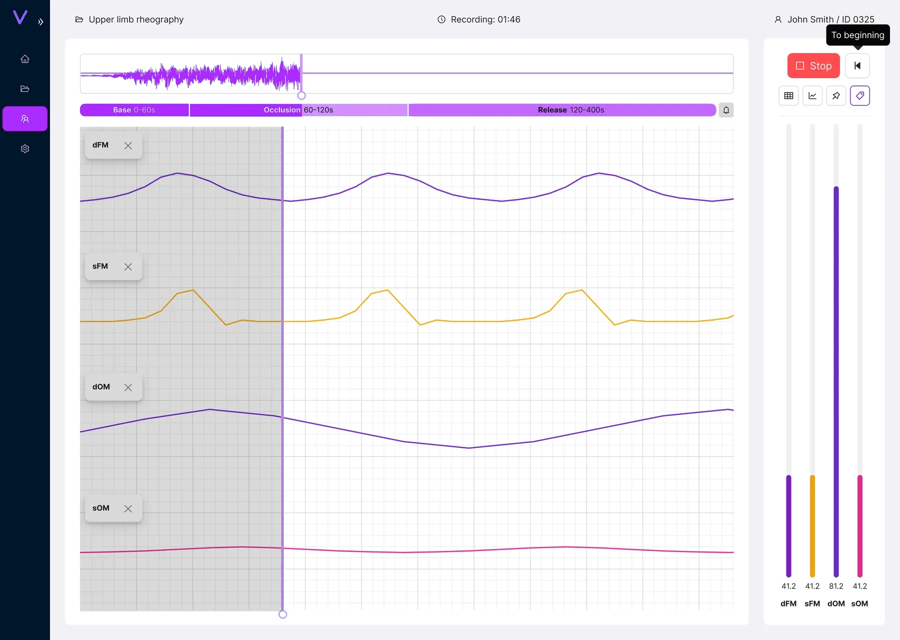 Redesigned VascuLab recording workspace